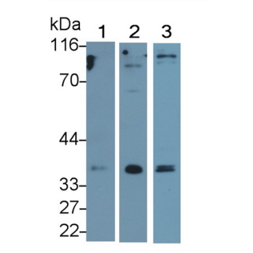 Beta-1,3-Glucuronyltransferase 1 (b3GAT1) Human Monoclonal Antibody