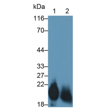 Cluster of Differentiation 59 (CD59) Human Monoclonal Antibody