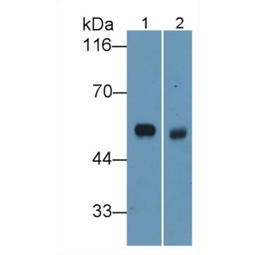 Elastin (ELN) Human Monoclonal Antibody