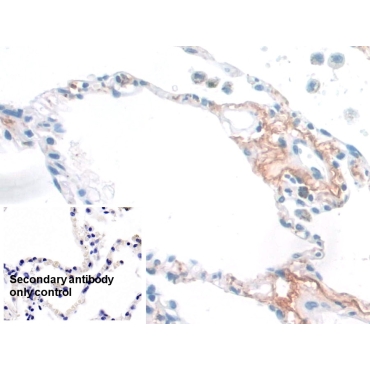 Elastin (ELN) Human Monoclonal Antibody