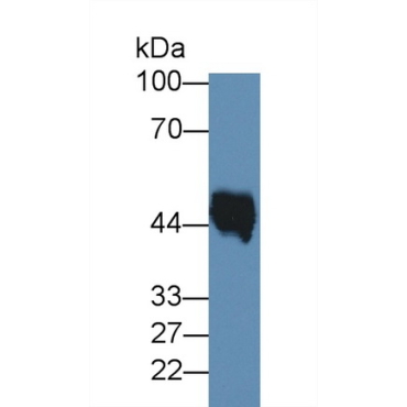 Elastin (ELN) Human Monoclonal Antibody