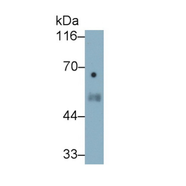 Elastin (ELN) Human Monoclonal Antibody