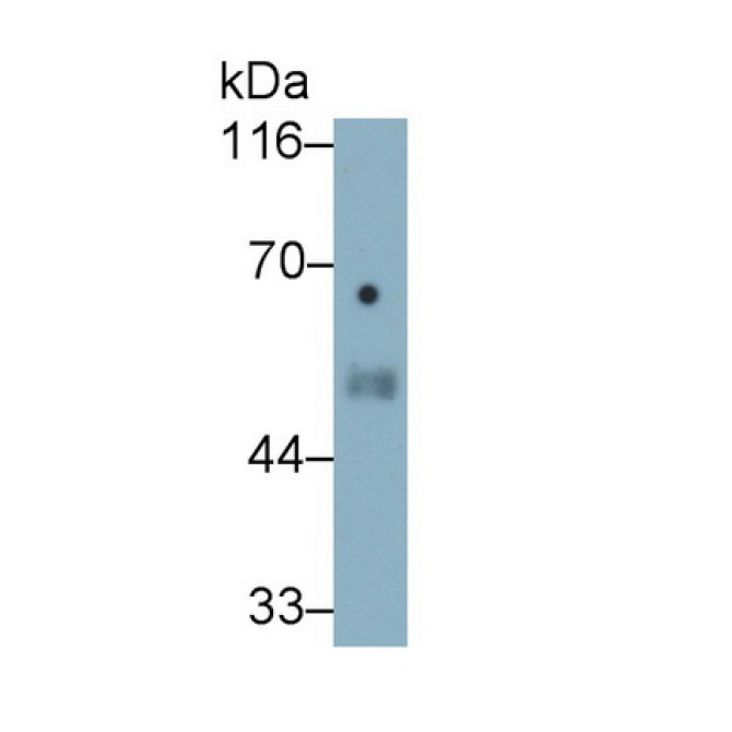 Elastin (ELN) Human Monoclonal Antibody