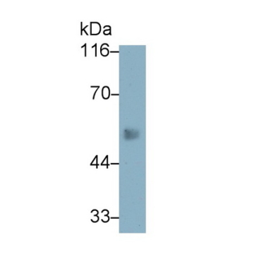 Elastin (ELN) Human Monoclonal Antibody
