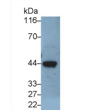 Elastin (ELN) Human Monoclonal Antibody