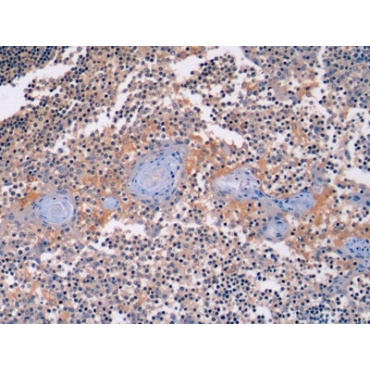 Beta Actin (ACTB) Human Monoclonal Antibody