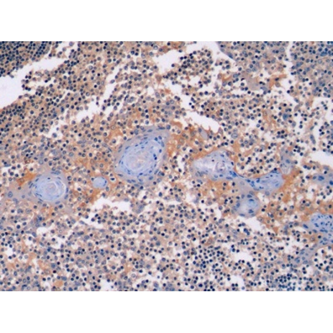 Beta Actin (ACTB) Human Monoclonal Antibody