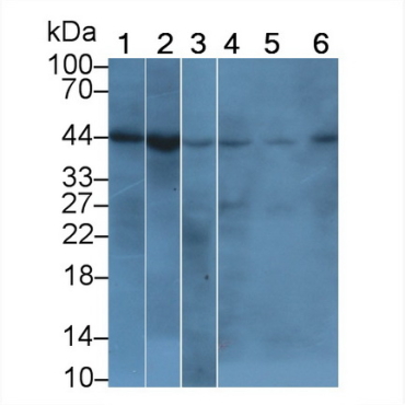 Beta Actin (ACTB) Human Monoclonal Antibody