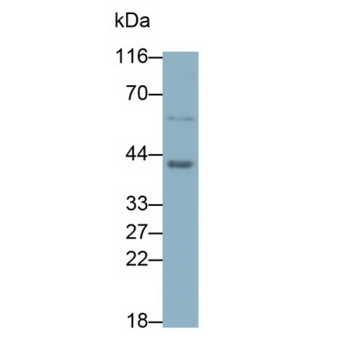 Beta Actin (ACTB) Human Monoclonal Antibody