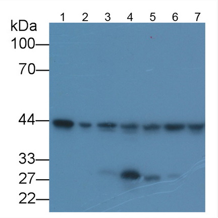 Beta Actin (ACTB) Human, Mouse, Rat, Guinea Pig, Canis familiaris; Canine (Dog), Pig, Bovine (Cattle), Ovis aries; Ovine (Sheep), Equus caballus; Equine (Horse), Chicken (Gallus) Monoclonal Antibody