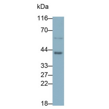 Beta Actin (ACTB) Human Monoclonal Antibody