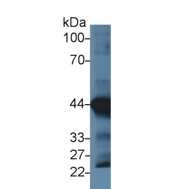 Actin Alpha 1, Cardiac Muscle (ACTC1) Human Monoclonal Antibody