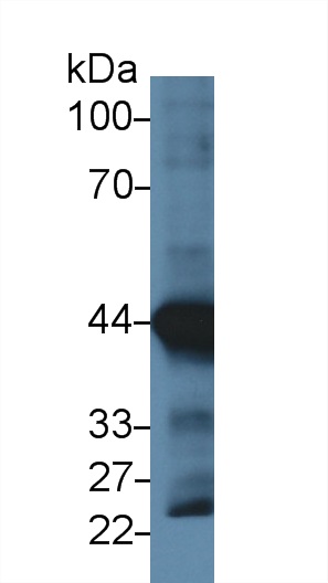 Actin Alpha 1, Cardiac Muscle (ACTC1) Human Monoclonal Antibody
