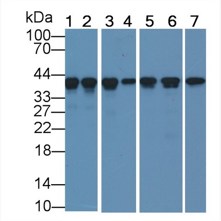 Actin Alpha 1, Cardiac Muscle (ACTC1) Human Monoclonal Antibody