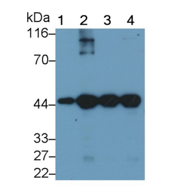 Actin Alpha 1, Cardiac Muscle (ACTC1) Human Monoclonal Antibody