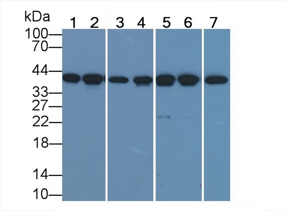 Actin Alpha 1, Cardiac Muscle (ACTC1) Human Monoclonal Antibody