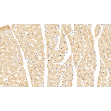 Actin Alpha 1, Cardiac Muscle (ACTC1) Human Monoclonal Antibody