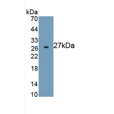 Actin Alpha 2, Smooth Muscle (ACTa2) Human Monoclonal Antibody