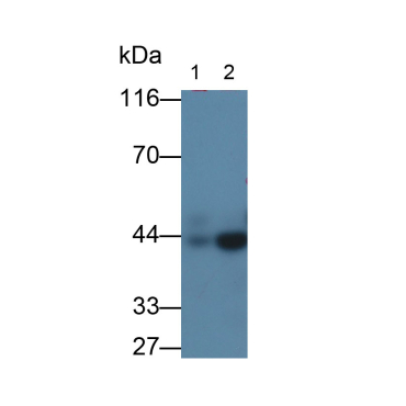 Actin Alpha 2, Smooth Muscle (ACTa2) Human Monoclonal Antibody