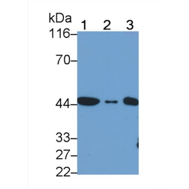 Actin Alpha 2, Smooth Muscle (ACTa2) Human, Mouse, Rat Monoclonal Antibody
