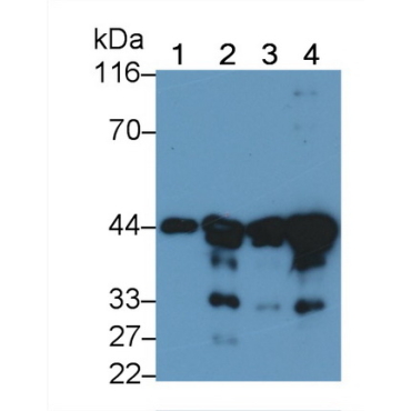 Actin Alpha 2, Smooth Muscle (ACTa2) Human, Mouse, Rat Monoclonal Antibody