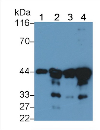 Actin Alpha 2, Smooth Muscle (ACTa2) Human, Mouse, Rat Monoclonal Antibody