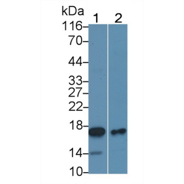 Bcl2 Associated X Protein (Bax) Human Monoclonal Antibody