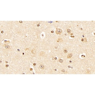 Aryl Hydrocarbon Receptor (AhR) Human Monoclonal Antibody