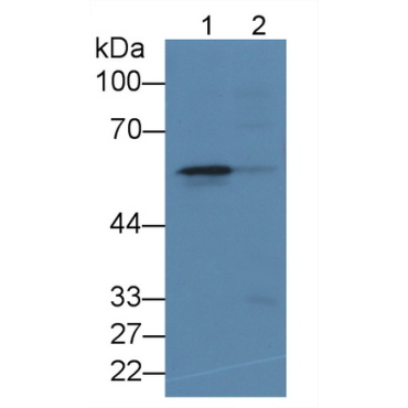 5-Lipoxygenase (5-LO) Human Monoclonal Antibody