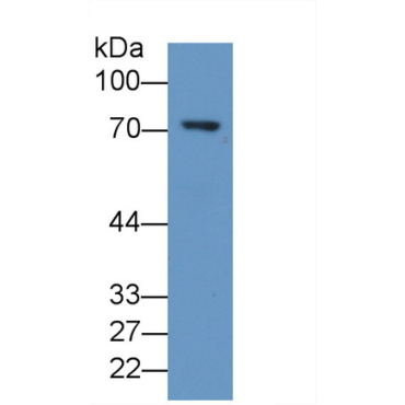 5-Lipoxygenase (5-LO) Human Monoclonal Antibody