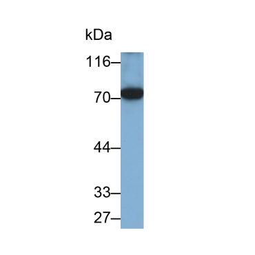 5-Lipoxygenase (5-LO) Human Monoclonal Antibody