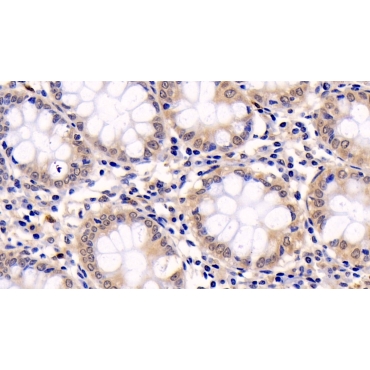 Extracellular Signal Regulated Kinase 1 (ERK1) Human Monoclonal Antibody