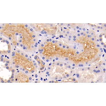 Extracellular Signal Regulated Kinase 1 (ERK1) Human Monoclonal Antibody