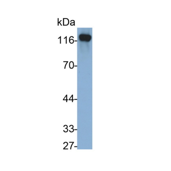 Cadherin 5 (CDH5) Human Monoclonal Antibody