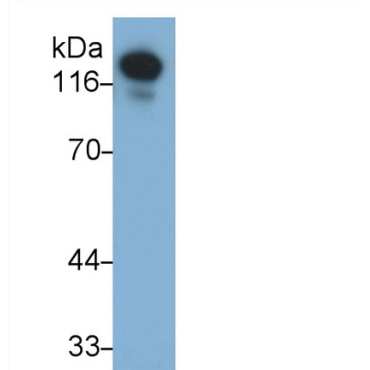Cadherin 5 (CDH5) Human Monoclonal Antibody