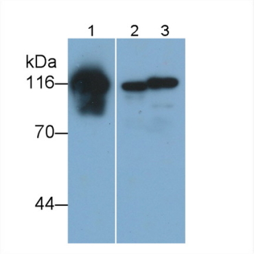 Cadherin 5 (CDH5) Human Monoclonal Antibody