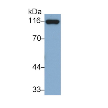 Cadherin 5 (CDH5) Human Monoclonal Antibody