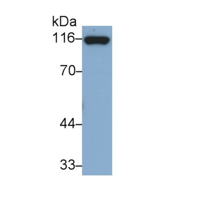 Cadherin 5 (CDH5) Human Monoclonal Antibody