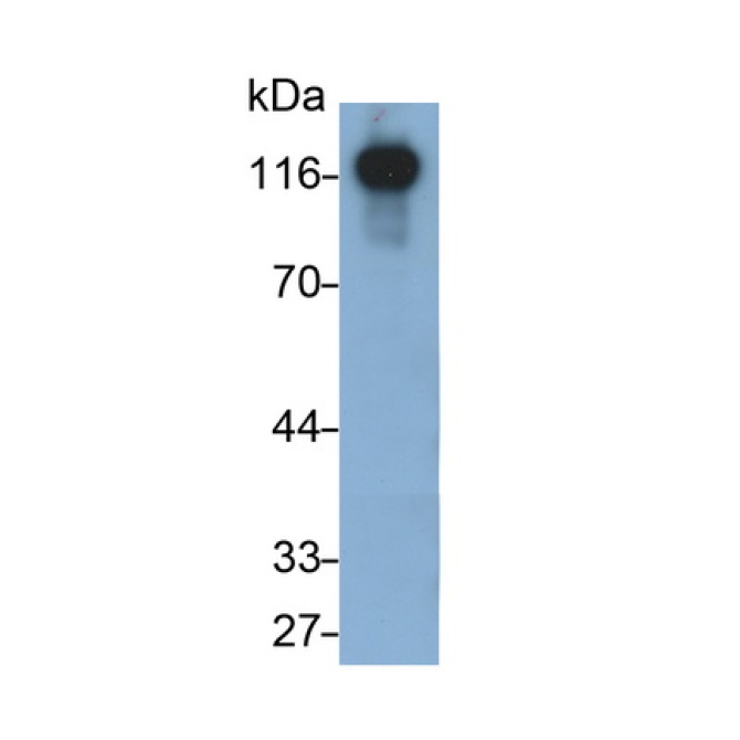 Cadherin 5 (CDH5) Human Monoclonal Antibody