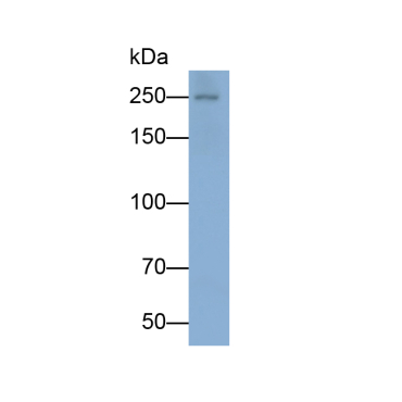 Vascular Endothelial Growth Factor Receptor 2 (VEGFR2) Human Monoclonal Antibody