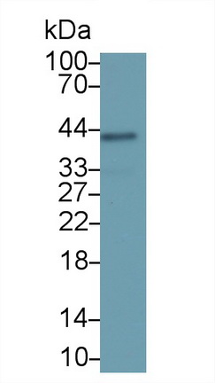 Serpin B3 (SERPINB3) Human Monoclonal Antibody