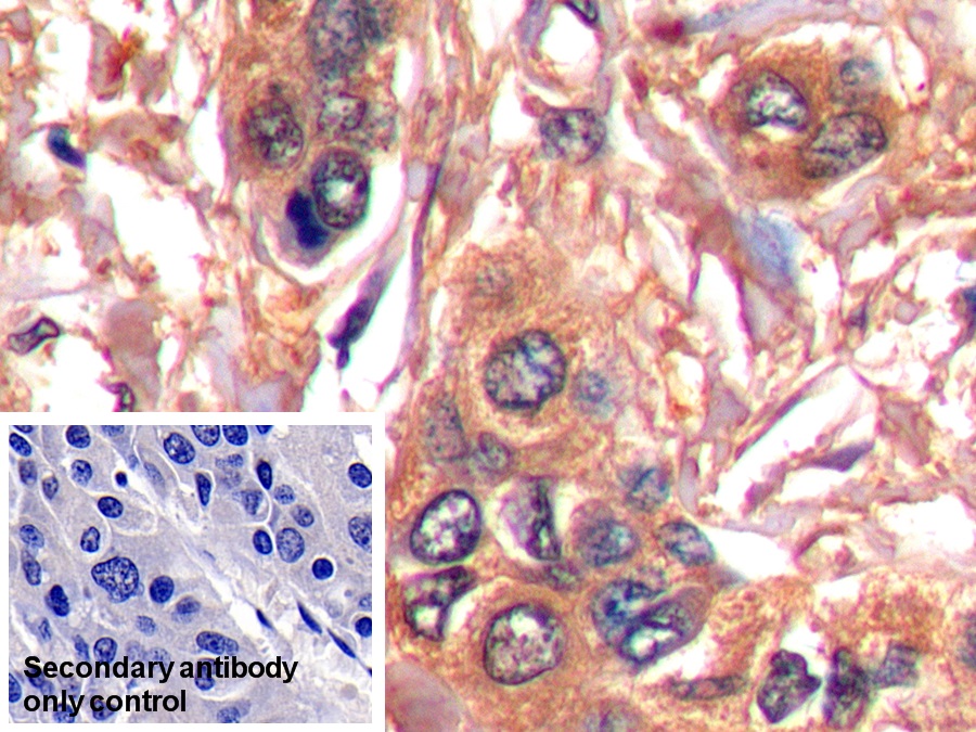 Serpin B3 (SERPINB3) Human Monoclonal Antibody