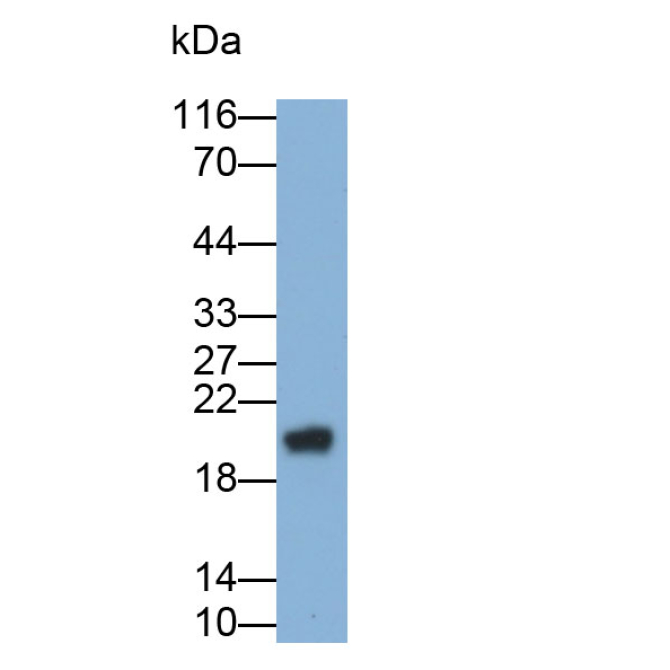 Gamma-Glutamyltransferase 1 (gGT1) Human Monoclonal Antibody
