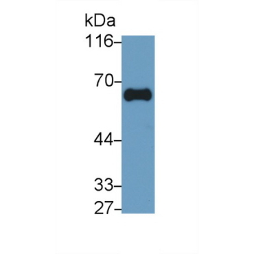Gamma-Glutamyltransferase 1 (gGT1) Human Monoclonal Antibody