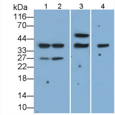 Cluster of Differentiation 79B (CD79B) Human Monoclonal Antibody