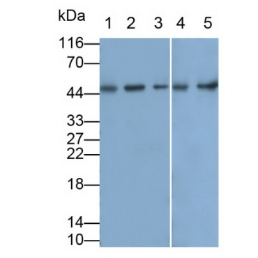 Cluster of Differentiation 79B (CD79B) Human Monoclonal Antibody