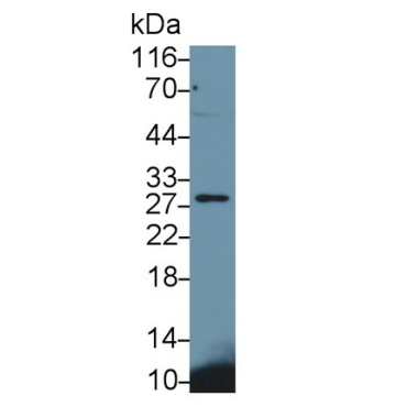 Cluster of Differentiation 79B (CD79B) Human Monoclonal Antibody