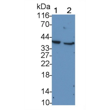 Cluster of Differentiation 79B (CD79B) Human Monoclonal Antibody