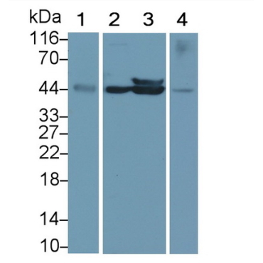 Cluster of Differentiation 79B (CD79B) Human Monoclonal Antibody