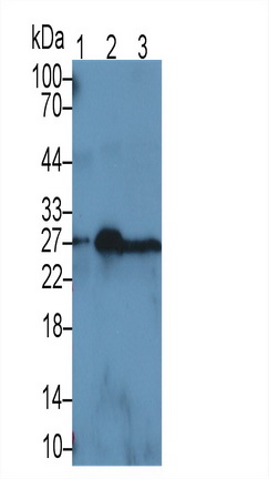 Neutrophil gelatinase-associated lipocalin (NGAL) Rat Monoclonal Antibody